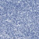 ASGR1 Antibody in Immunohistochemistry (IHC)