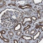 C20orf3 Polyclonal Antibody