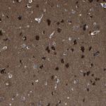 KIAA0513 Antibody in Immunohistochemistry (IHC)