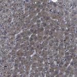 KIAA0513 Antibody in Immunohistochemistry (IHC)