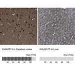 KIAA0513 Antibody