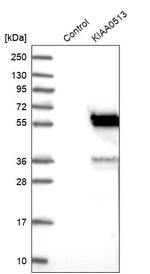 KIAA0513 Antibody in Western Blot (WB)