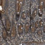 PDE5 Polyclonal Antibody