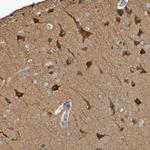 SCRG1 Polyclonal Antibody