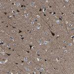 CENTG3 Antibody in Immunohistochemistry (Paraffin) (IHC (P))
