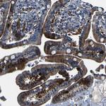 CENTG3 Antibody in Immunohistochemistry (Paraffin) (IHC (P))