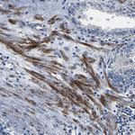 CENTG3 Polyclonal Antibody