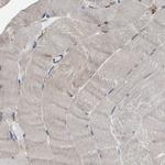 CENTG3 Antibody in Immunohistochemistry (Paraffin) (IHC (P))