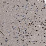 CHST10 Antibody in Immunohistochemistry (Paraffin) (IHC (P))