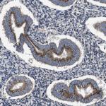 CHST10 Antibody in Immunohistochemistry (Paraffin) (IHC (P))