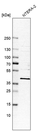 CHST10 Antibody in Western Blot (WB)