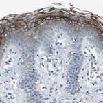 DSC1 Antibody in Immunohistochemistry (IHC)