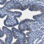 DSC1 Polyclonal Antibody