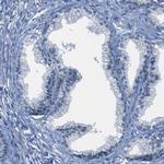 DSC1 Antibody in Immunohistochemistry (IHC)