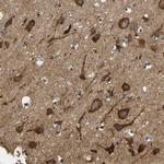 LRRCC1 Polyclonal Antibody