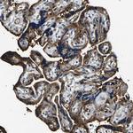 RHOT2 Antibody in Immunohistochemistry (IHC)