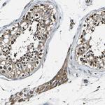 RHOT2 Antibody in Immunohistochemistry (IHC)