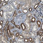 RHOT2 Antibody in Immunohistochemistry (IHC)