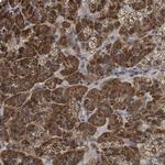 C17orf80 Antibody in Immunohistochemistry (Paraffin) (IHC (P))