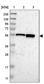 C17orf80 Antibody in Western Blot (WB)
