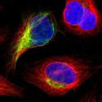 IGSF10 Polyclonal Antibody