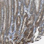ANKRD22 Antibody in Immunohistochemistry (Paraffin) (IHC (P))