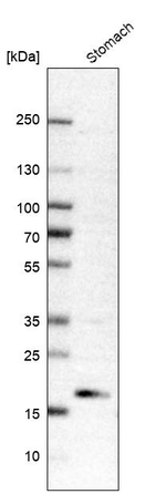 ANKRD22 Antibody in Western Blot (WB)