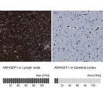 ARHGEF1 Antibody in Immunohistochemistry (IHC)