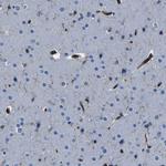 ARHGEF1 Antibody in Immunohistochemistry (IHC)