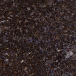 ARHGEF1 Antibody in Immunohistochemistry (IHC)