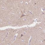 TMEM130 Antibody in Immunohistochemistry (Paraffin) (IHC (P))