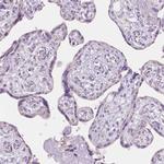 TMEM130 Antibody in Immunohistochemistry (Paraffin) (IHC (P))