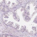 TMEM130 Antibody in Immunohistochemistry (Paraffin) (IHC (P))