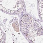 TMEM130 Antibody in Immunohistochemistry (Paraffin) (IHC (P))