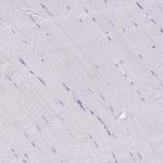 Cathepsin E Antibody in Immunohistochemistry (Paraffin) (IHC (P))