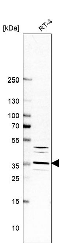 Cathepsin E Antibody in Western Blot (WB)