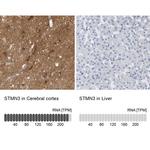 STMN3 Polyclonal Antibody