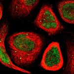 MYEOV Polyclonal Antibody