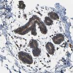 MYEOV Antibody in Immunohistochemistry (Paraffin) (IHC (P))