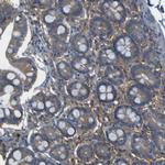 MYEOV Antibody in Immunohistochemistry (Paraffin) (IHC (P))