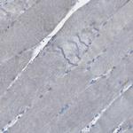 MYEOV Antibody in Immunohistochemistry (Paraffin) (IHC (P))