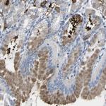 MYEOV Antibody in Immunohistochemistry (Paraffin) (IHC (P))