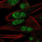 PNMAL1 Polyclonal Antibody