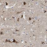 PNMAL1 Antibody in Immunohistochemistry (Paraffin) (IHC (P))