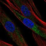 Mimecan Polyclonal Antibody