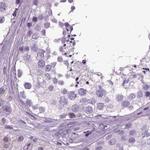 SCG5 Antibody in Immunohistochemistry (IHC)