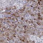 PENK Antibody in Immunohistochemistry (IHC)