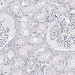 PENK Antibody in Immunohistochemistry (IHC)