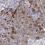 PENK Polyclonal Antibody