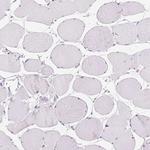 BEND2 Antibody in Immunohistochemistry (Paraffin) (IHC (P))